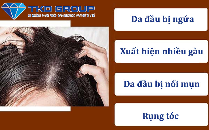 bieu-hien-cua-nam-da-dau