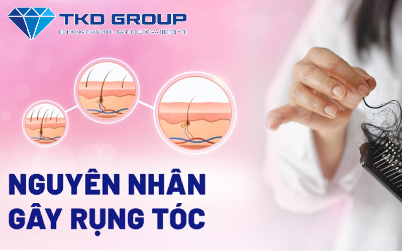 nguyen-nhan-gay-rung-toc