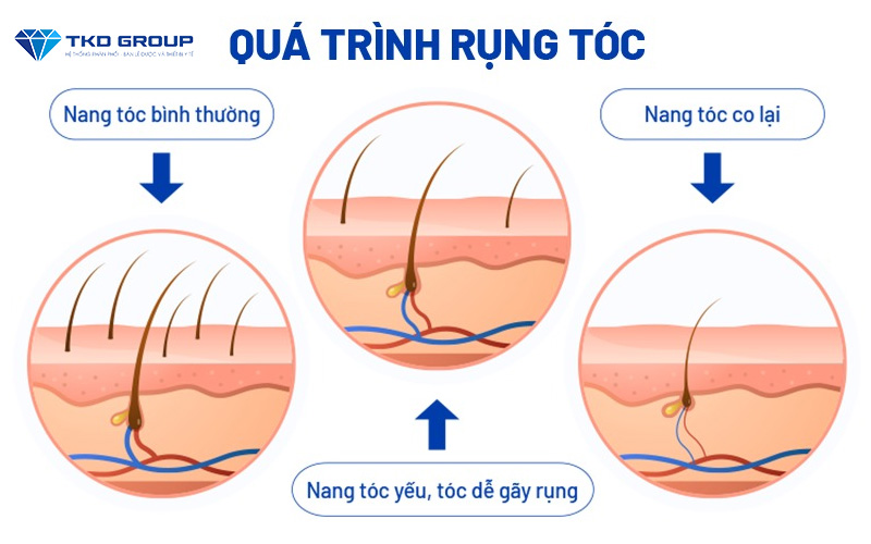 qua-trinh-rung-toc