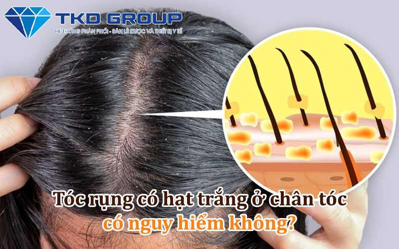 rung-toc-co-hat-trang-o-chan-toc-nguy-hiem-khong