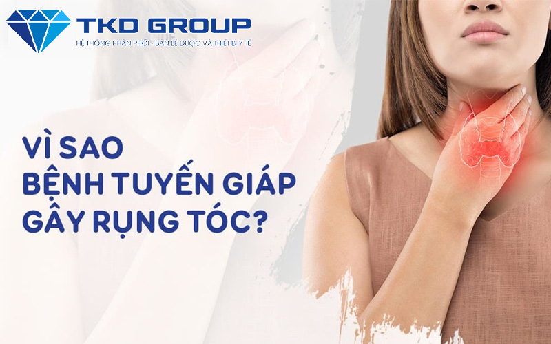 rung-toc-vi-benh-tuyen-giap