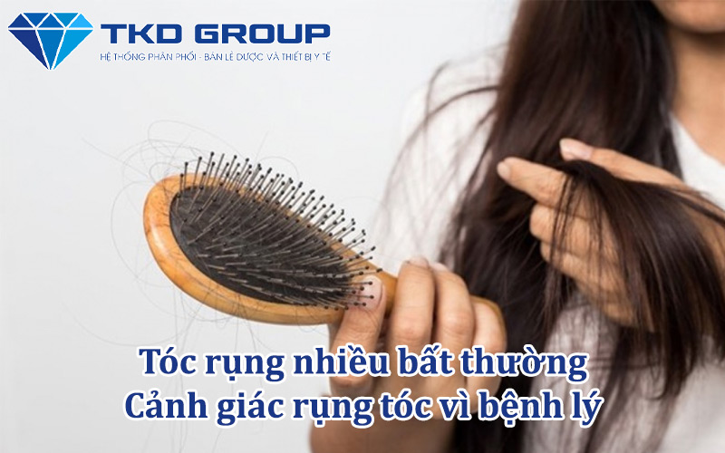 toc-rung-nhieu-bat-thuong-canh-giac-rung-toc-vi-benh-ly