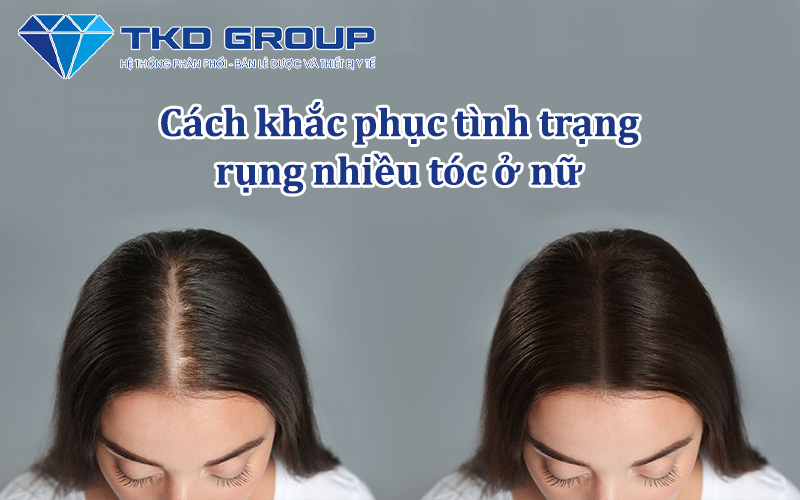 cach-khac-phuc-tinh-trang-rung-nhieu-toc-o-nu
