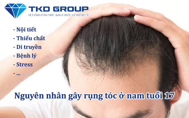 nguyen-nhan-gay-rung-toc-o-nam