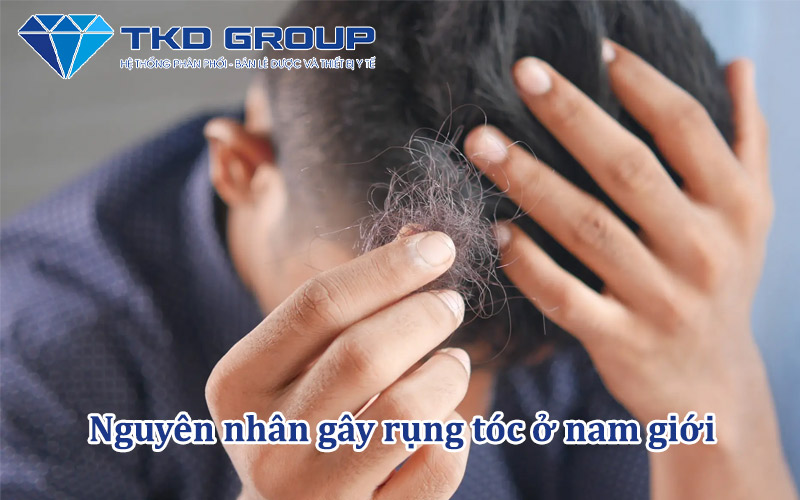 nguyen-nhan-rung-toc-o-nam-gioi