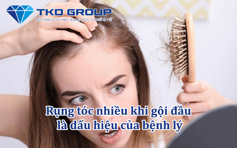 rung-toc-nhieu-khi-goi-dau-la-dau-hieu-cua-benh-ly