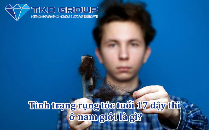 tinh-trang-rung-toc-tuoi-17-day-thi-o-nam-gioi-la-gi