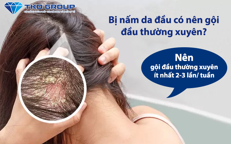 bi-nam-da-dau-co-nen-goi-dau-thuong-xuyen