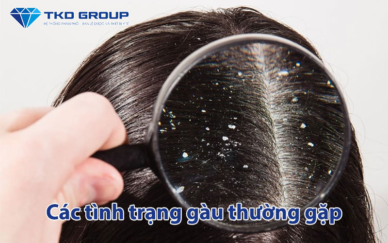 cac-tinh-trang-gau-thuong-gap