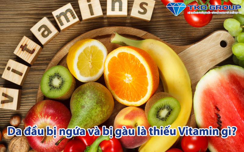 da-dau-bi-ngua-va-bi-gau-la-thieu-vitamin-gi