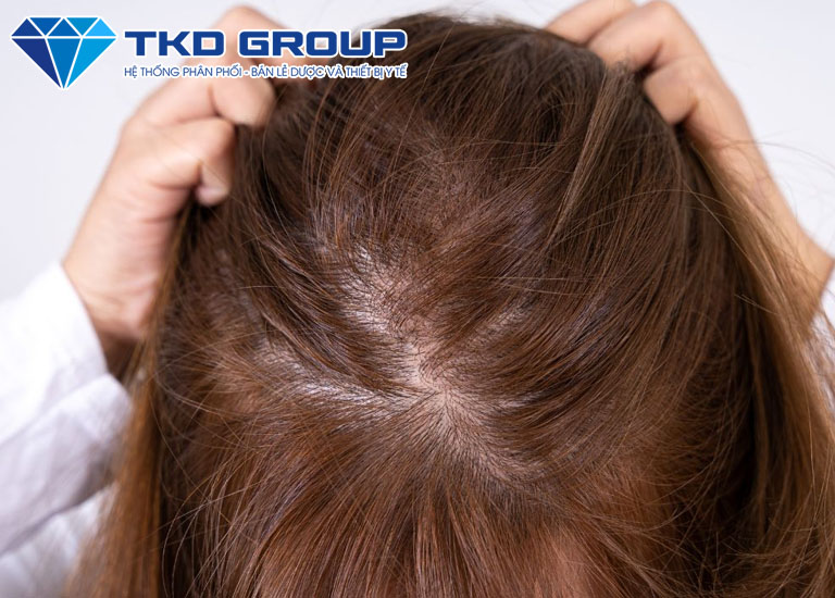 Tóc nữ mỏng nên để kiểu gì đẹp