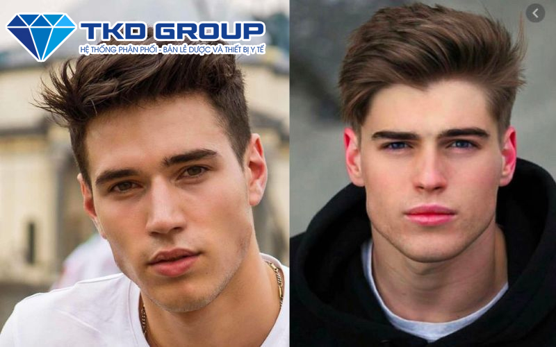 Tóc nam mỏng nên để kiểu gì - Undercut