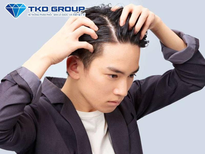 tóc nam bết dầu do cơ địa